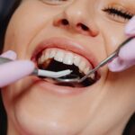 Tratamiento de implantes dentales: claves para una sonrisa llena de confianza
